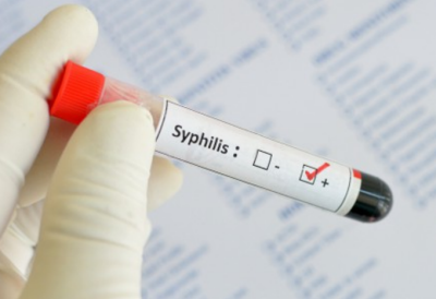 Azithromycin with syphilis