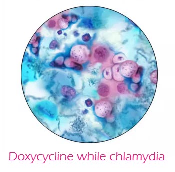 Doxycycline while chlamydia