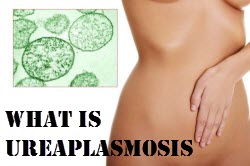 What is ureaplasmosis